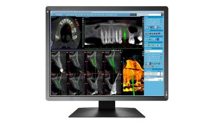 resulting in monochrome images that are displayed in the DICOM Part 14 grayscale